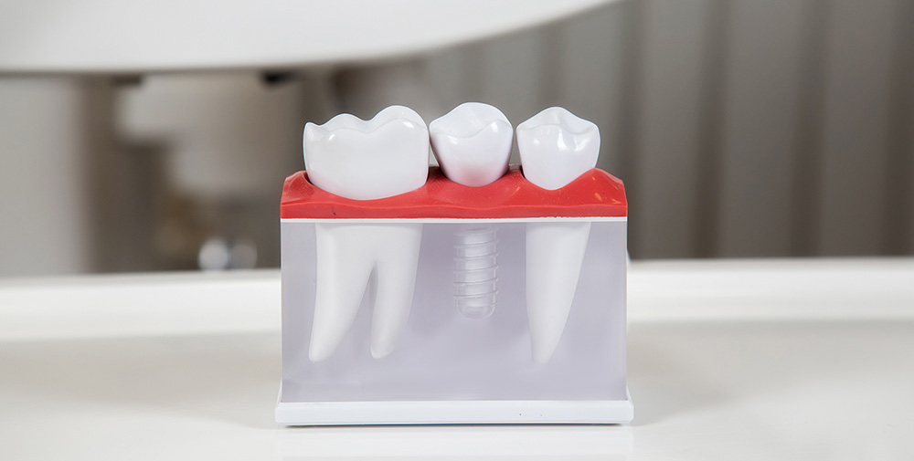 噛み合わせ専門の総合歯科医がプロデュース